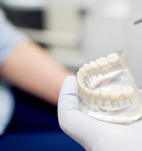 Free Orthodontic Exam Irvine 1