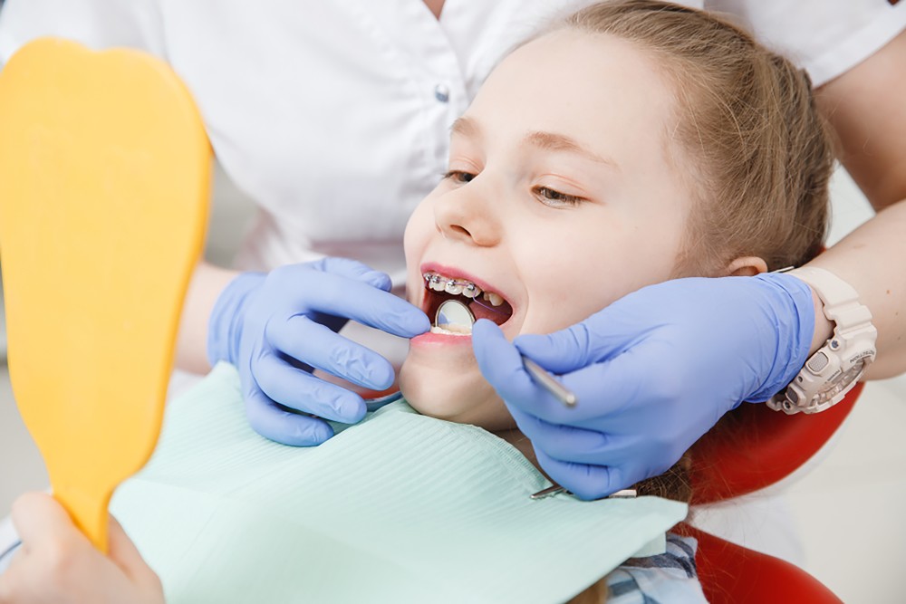 a few things parents must know before their child's braces treatment