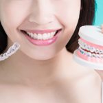 traditional braces vs invisalign