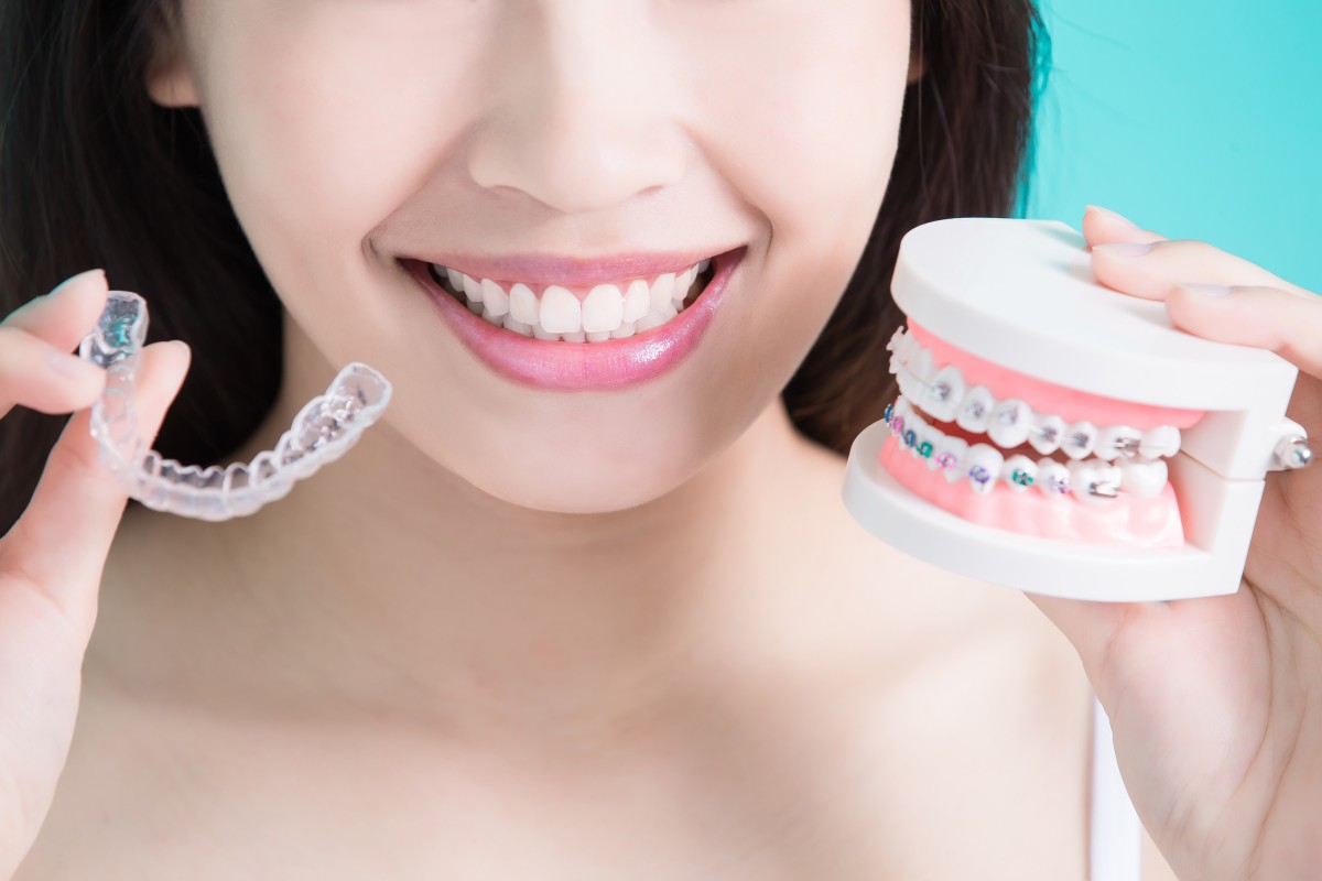 traditional braces vs invisalign