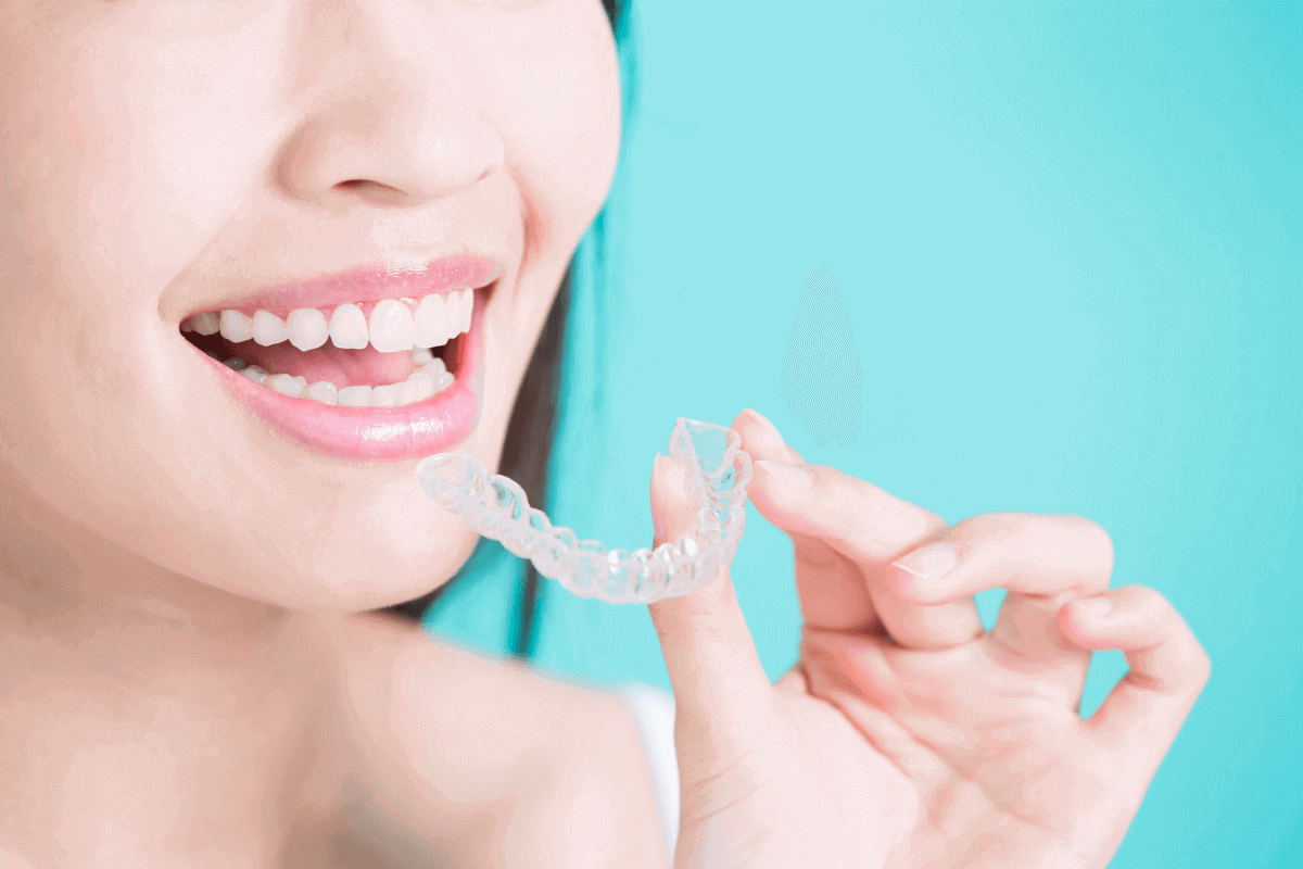 invisalign the best option for college goers