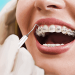 can you get orthodontic treatment as an adult