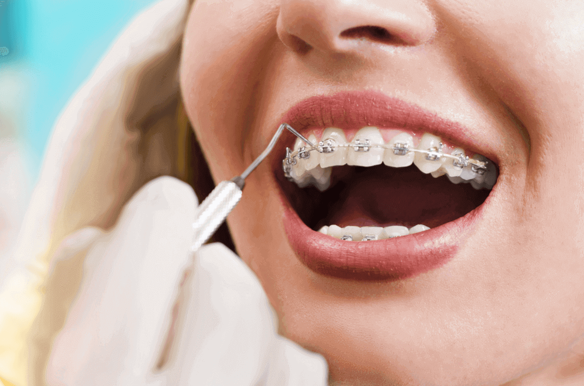 can you get orthodontic treatment as an adult
