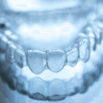 Is invisalign a good option for teens
