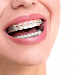 orthodontics for adults what options are open to you as an adult