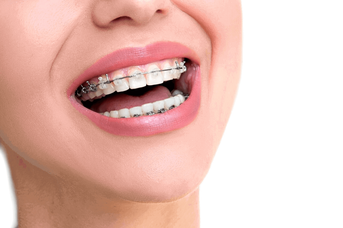 orthodontics for adults what options are open to you as an adult