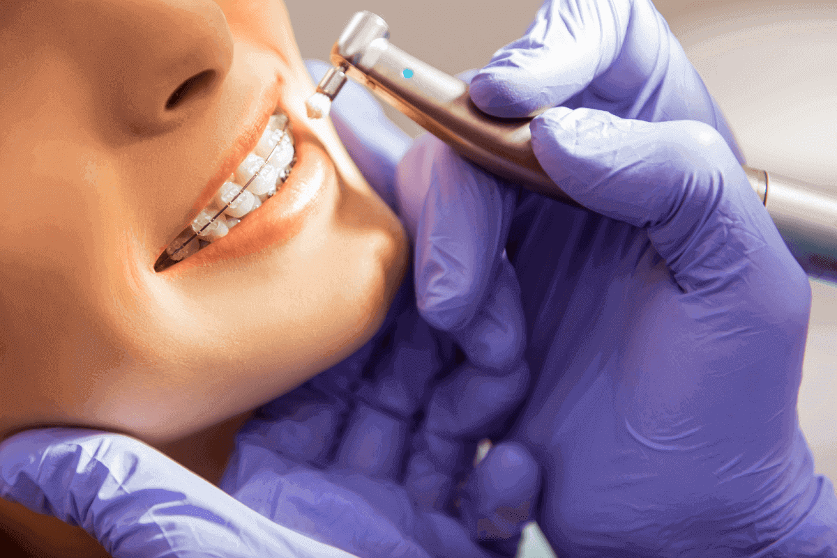 traditional braces when removed do they hurt and what you can expect